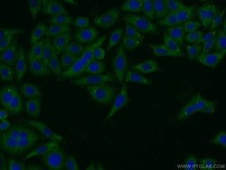 Pentraxin 3 Rabbit anti-Human, Mouse, Rat, Polyclonal, Proteintech:Antibodies:Primary