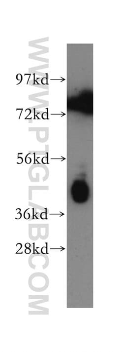 Pentraxin 3 Rabbit anti-Human, Mouse, Rat, Polyclonal, Proteintech:Antibodies:Primary