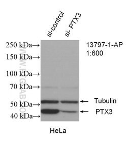 Pentraxin 3 Rabbit anti-Human, Mouse, Rat, Polyclonal, Proteintech:Antibodies:Primary