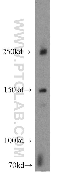 NPHP4 Rabbit anti-Canine, Human, Mouse, Polyclonal, Proteintech 150 &mu;L;