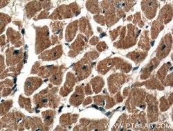 DIXDC1 Rabbit anti-Human, Mouse, Rat, Polyclonal, Proteintech:Antibodies:Primary
