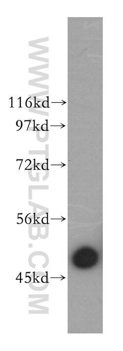 ARP3 Rabbit anti-Human, Mouse, Rat, Polyclonal, Proteintech 150 &mu;L;