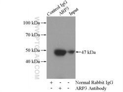 ARP3 Rabbit anti-Human, Mouse, Rat, Polyclonal, Proteintech 150 &mu;L;