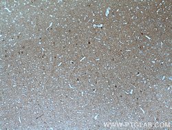 ATP6V0A1 Rabbit anti-Human, Mouse, Rat, Polyclonal, Proteintech:Antibodies:Primary