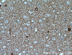 ATP6V0A1 Rabbit anti-Human, Mouse, Rat, Polyclonal, Proteintech:Antibodies:Primary