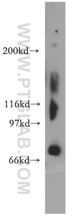 TIGD1 Rabbit anti-Human, Polyclonal, Proteintech:Antibodies:Primary Antibodies