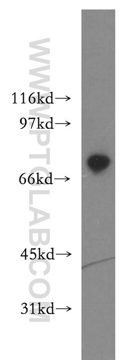 TIGD1 Rabbit anti-Human, Polyclonal, Proteintech:Antibodies:Primary Antibodies