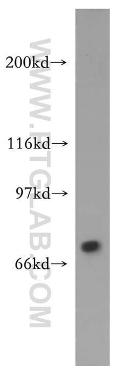 TIGD1 Rabbit anti-Human, Polyclonal, Proteintech:Antibodies:Primary Antibodies