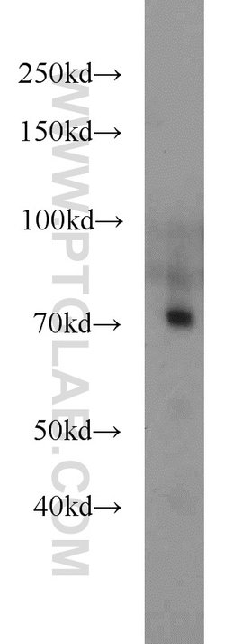 TCF7L2 Rabbit anti-Human, Mouse, Rat, Polyclonal, Proteintech 150 &mu;L;