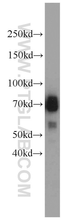 TCF7L2 Rabbit anti-Human, Mouse, Rat, Polyclonal, Proteintech 150 &mu;L;