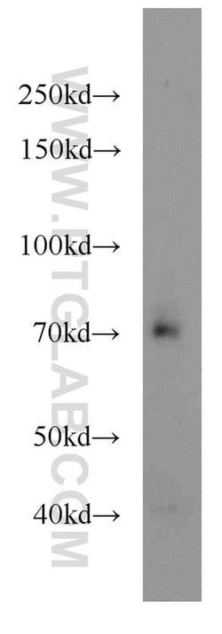 TCF7L2 Rabbit anti-Human, Mouse, Rat, Polyclonal, Proteintech 150 &mu;L;