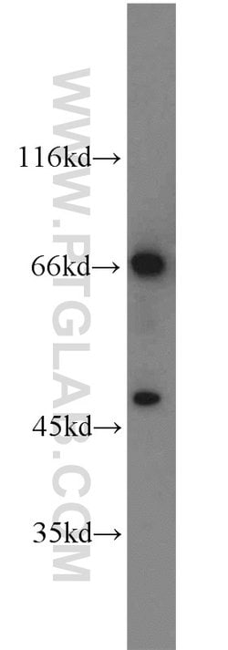 TCF7L2 Rabbit anti-Human, Mouse, Rat, Polyclonal, Proteintech 150 &mu;L;