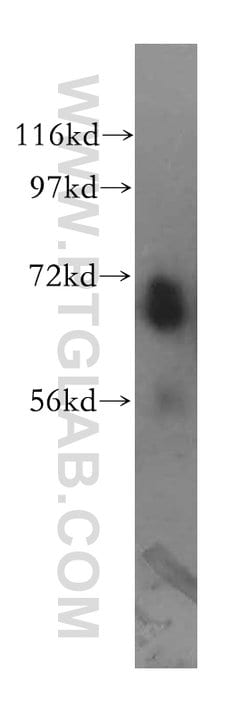 TCF7L2 Rabbit anti-Human, Mouse, Rat, Polyclonal, Proteintech 150 &mu;L;