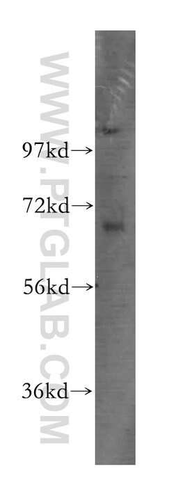 TCF7L2 Rabbit anti-Human, Mouse, Rat, Polyclonal, Proteintech 150 &mu;L;