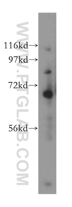 TCF7L2 Rabbit anti-Human, Mouse, Rat, Polyclonal, Proteintech 150 &mu;L;