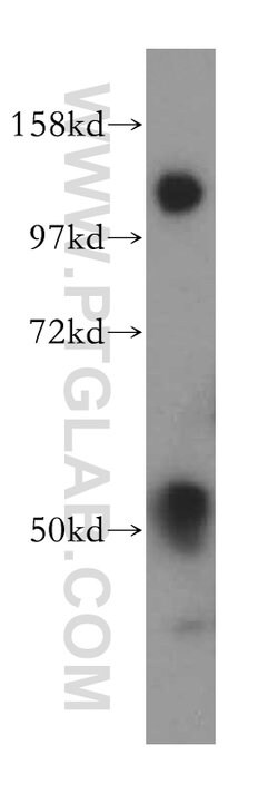MOF Rabbit anti-Human, Mouse, Rat, Polyclonal, Proteintech 150 &mu;L; Unconjugated:Antibodies,