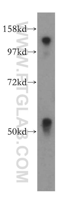 MOF Rabbit anti-Human, Mouse, Rat, Polyclonal, Proteintech 150 &mu;L; Unconjugated:Antibodies,