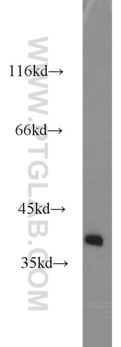SH3GL3 Rabbit anti-Human, Mouse, Rat, Polyclonal, Proteintech:Antibodies:Primary
