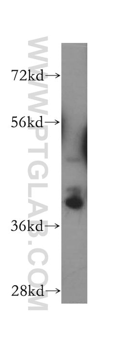 SH3GL3 Rabbit anti-Human, Mouse, Rat, Polyclonal, Proteintech:Antibodies:Primary
