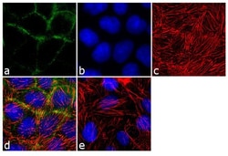 Invitrogen gamma Catenin Monoclonal Antibody (PG-11E4) 100 &mu;g; Unconjugated:Antibodies,