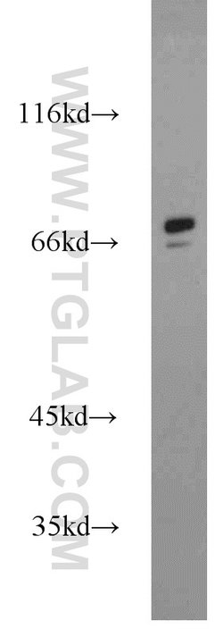 SORBS1 Rabbit anti-Human, Mouse, Polyclonal, Proteintech:Antibodies:Primary