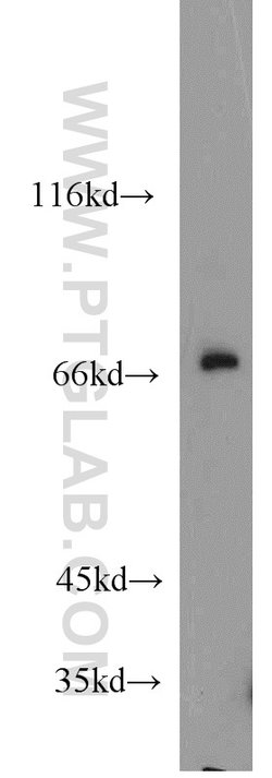 SORBS1 Rabbit anti-Human, Mouse, Polyclonal, Proteintech:Antibodies:Primary