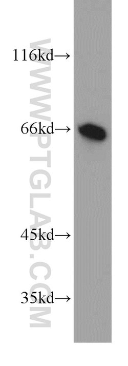 UBP1 Rabbit anti-Human, Mouse, Rat, Polyclonal, Proteintech:Antibodies:Primary