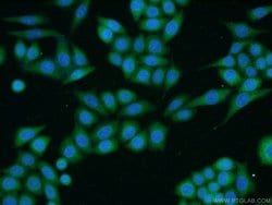 TACC1 Rabbit anti-Human, Polyclonal, Proteintech 150 &mu;L; Unconjugated:Antibodies,