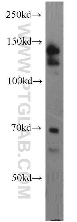 TACC1 Rabbit anti-Human, Polyclonal, Proteintech 150 &mu;L; Unconjugated:Antibodies,