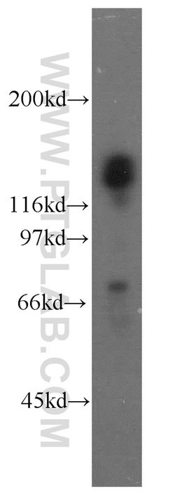 TACC1 Rabbit anti-Human, Polyclonal, Proteintech 150 &mu;L; Unconjugated:Antibodies,