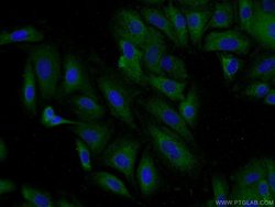 DCP1B Rabbit anti-Human, Mouse, Rat, Polyclonal, Proteintech 150 &mu;L;