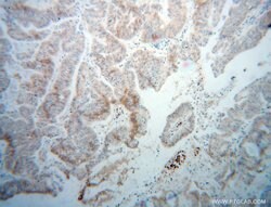 DCP1B Rabbit anti-Human, Mouse, Rat, Polyclonal, Proteintech 150 &mu;L;