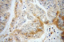 DCP1B Rabbit anti-Human, Mouse, Rat, Polyclonal, Proteintech 150 &mu;L;