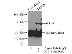 DCP1B Rabbit anti-Human, Mouse, Rat, Polyclonal, Proteintech 150 &mu;L;