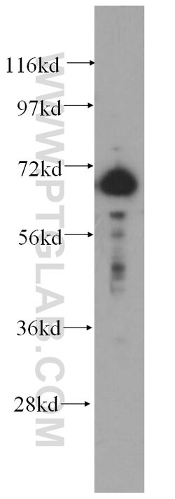 DCP1B Rabbit anti-Human, Mouse, Rat, Polyclonal, Proteintech 150 &mu;L;