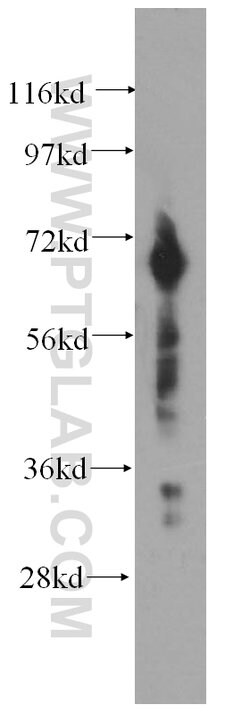 DCP1B Rabbit anti-Human, Mouse, Rat, Polyclonal, Proteintech 150 &mu;L;