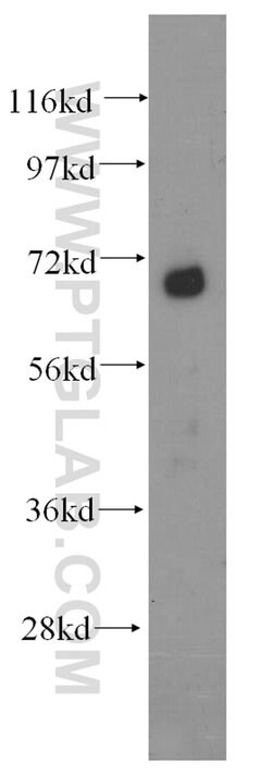 DCP1B Rabbit anti-Human, Mouse, Rat, Polyclonal, Proteintech 150 &mu;L;