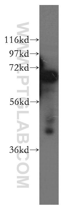 DCP1B Rabbit anti-Human, Mouse, Rat, Polyclonal, Proteintech 150 &mu;L;