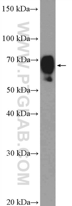 DCP1B Rabbit anti-Human, Mouse, Rat, Polyclonal, Proteintech 150 &mu;L;