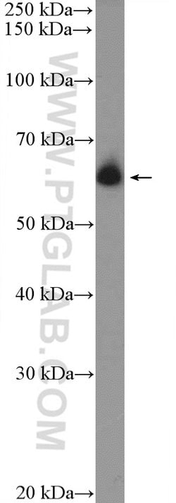 DCP1B Rabbit anti-Human, Mouse, Rat, Polyclonal, Proteintech 150 &mu;L;