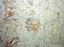 KBTBD2 Rabbit anti-Human, Mouse, Rat, Polyclonal, Proteintech 150 &mu;L;