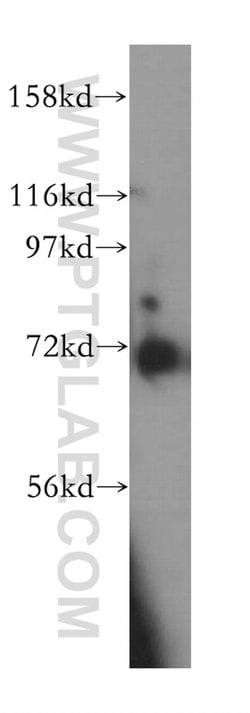KBTBD2 Rabbit anti-Human, Mouse, Rat, Polyclonal, Proteintech 150 &mu;L;