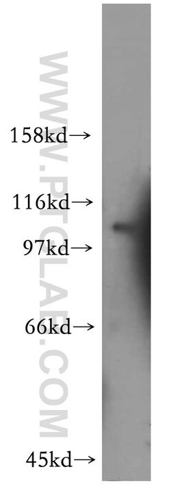 EPAC2 Rabbit anti-Human, Mouse, Rat, Polyclonal, Proteintech 20 &mu;L | Buy Online | Proteintech | Fisher Scientific