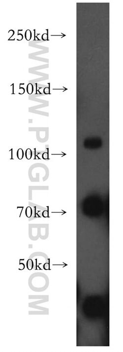 EPAC2 Rabbit anti-Human, Mouse, Rat, Polyclonal, Proteintech 20 &mu;L | Buy Online | Proteintech | Fisher Scientific