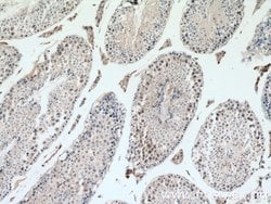SIAH1 Rabbit anti-Human, Mouse, Polyclonal, Proteintech:Antibodies:Primary