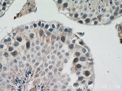 SIAH1 Rabbit anti-Human, Mouse, Polyclonal, Proteintech:Antibodies:Primary