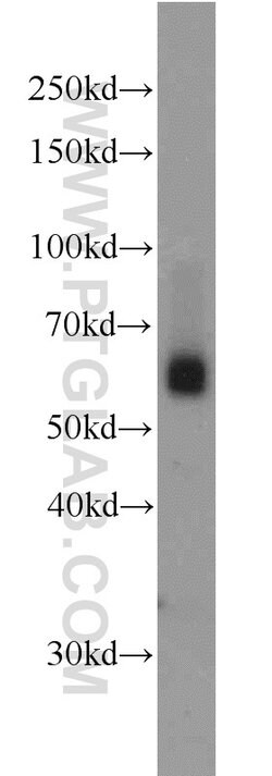 SIAH1 Rabbit anti-Human, Mouse, Polyclonal, Proteintech:Antibodies:Primary