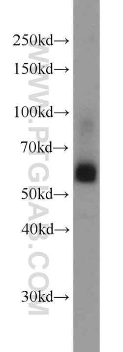 SIAH1 Rabbit anti-Human, Mouse, Polyclonal, Proteintech:Antibodies:Primary