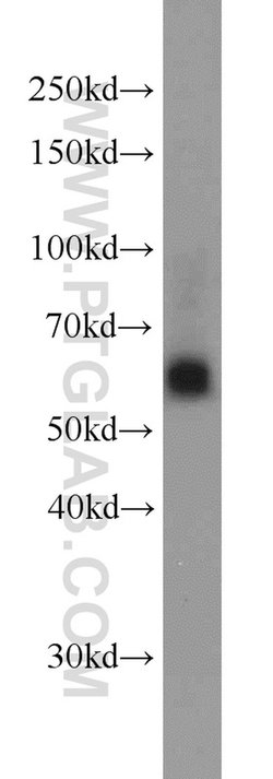 SIAH1 Rabbit anti-Human, Mouse, Polyclonal, Proteintech:Antibodies:Primary