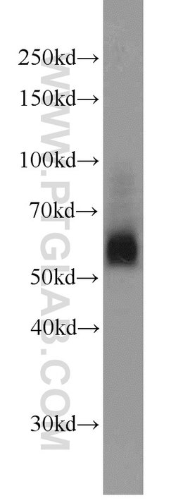 SIAH1 Rabbit anti-Human, Mouse, Polyclonal, Proteintech:Antibodies:Primary